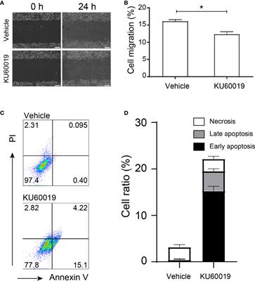 Blocking ATM Attenuates SKOV3 Cell Proliferation and Migration by Disturbing OGT/OGA Expression via hsa-miR-542-5p